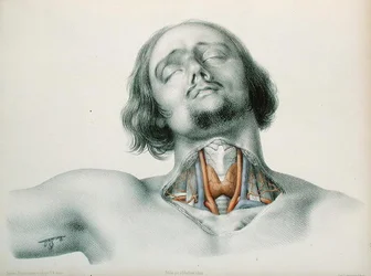 Przekrój gardła z „Anomalies Arterielles” Jean-Baptiste-Leon Dubreuil