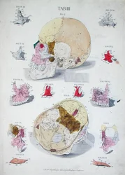 Kości czaszki, z „Tabulae Osteologicae” Christopha Jacoba Trewa (1695-1769) rytowane przez G. Lichtenstegera