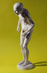 Figura kobiety z chorobą Parkinsona (gips)