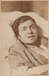 Epilepsja histeryczna, skurcz twarzy, płyta VIII z "Iconographie Photographique de La Salpetriere" Bourneville et P. Regnard, Paryż, 1876 (odbitka albuminowa)