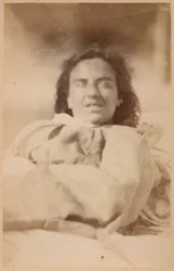 Padaczka histeryczna, halucynacje, ironia, tablica XXXII z „Iconographie Photographique de La Salpêtrière” Bourneville