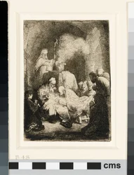 Obrzezanie