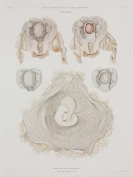 Ginekologia Ludzka macica z zarodkiem, ok. 1847-1859
