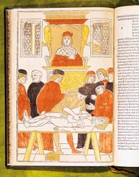 Wykład anatomii w Padwie, Włochy, 1483