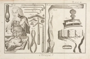 Trepanacja