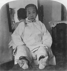 Delikatne liliowe stopy damy z wysokiej kasty, ukazujące metodę deformacji, Chiny, 1900.