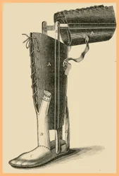 Wymiana nogi