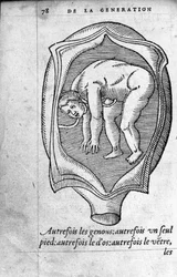 Pozycja płodu w macicy podczas ciąży. Rycina z „De la generation des enfants” autorstwa francuskiego lekarza i chirurga Ambroise Pare (1509-1590) XVI wiek