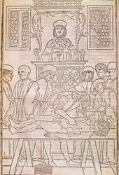 Autopsja. Kodeks. Lekarze rozbiorą ciało martwego mężczyzny w celu zbadania anatomii. „”Fasciculus Medicinae””.Kodeks fascykułu lekarskiego Johannesa Kethana