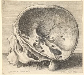 Przekrojona czaszka z profilu w lewo z usuniętą lewą stroną czaszki, 1651.