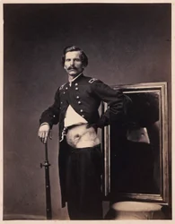Major H. A. Barnum, rekonwalescencja po penetrującej ranie postrzałowej brzucha z perforacją lewego biodra, z katalogu fotograficznego sekcji chirurgicznej