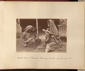 Dziecko urodzone przez matkę dotkniętą głodem - wiek: 3 miesiące, waga: 3 funty.