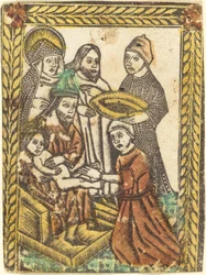 Obrzezanie